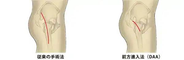 治療イメージ