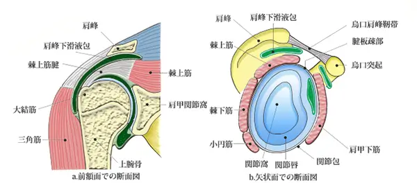 変性半月板損傷