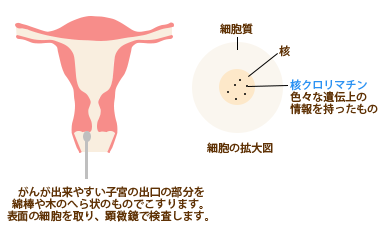 子宮頸がん 産婦人科 新百合ヶ丘総合病院