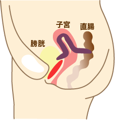 ステージⅣA