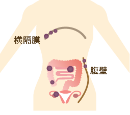 ステージ4