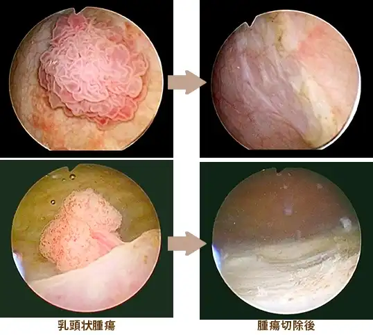 手術（外科治療）