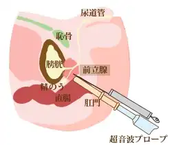 超音波（エコー）検査イラスト
