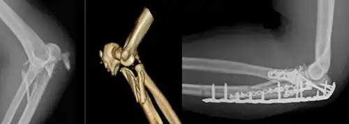 治療MRI