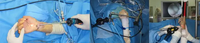 治療MRI