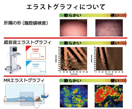 エストグラフィについて図にした画像