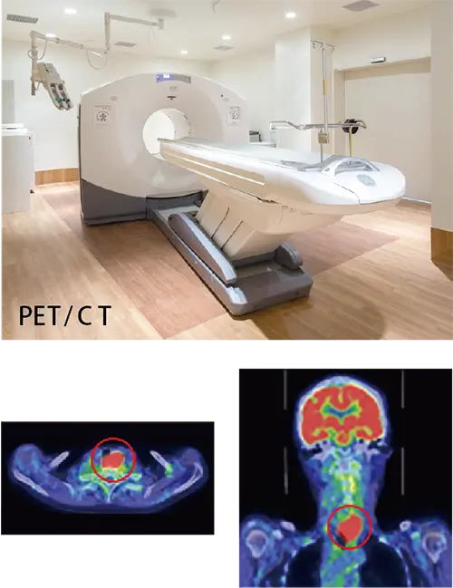 PET/CT検査