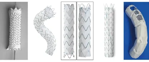 胸部大動脈瘤治療用のステントグラフト（５機種）