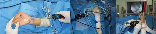 手術イメージ