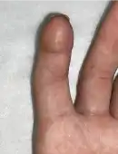 術後イメージ