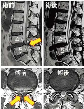 レントゲン写真