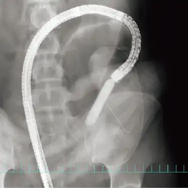 レントゲン写真