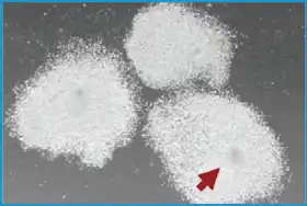 顕微鏡で見た卵子