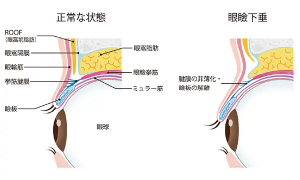 眼瞼の縦方向の断面